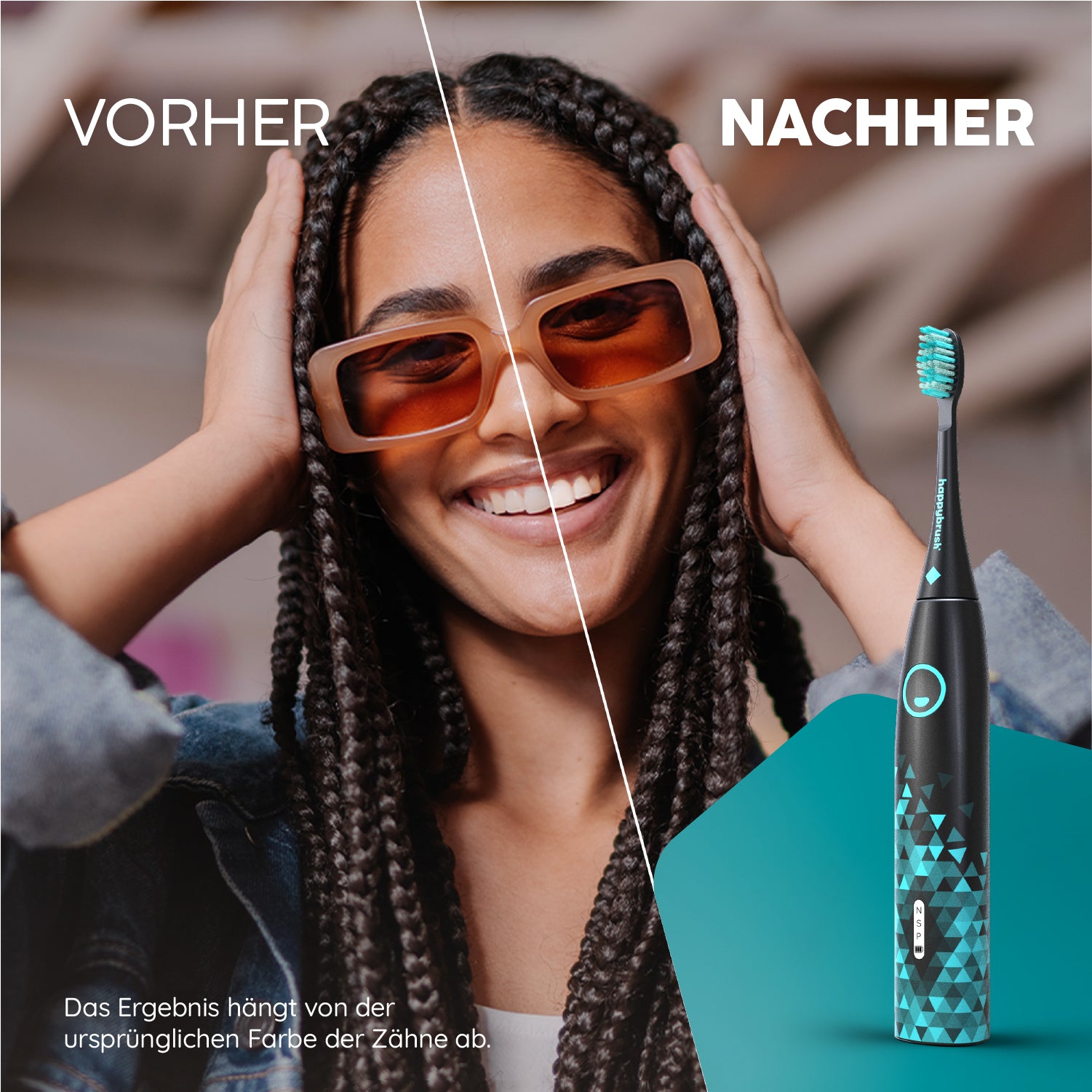 Vorher Nachher Vergleich mit der Schallzahnbürste