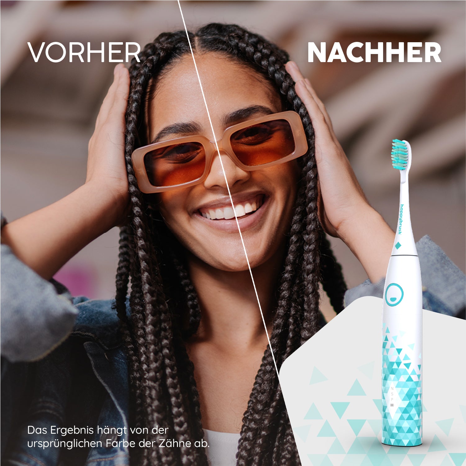 Vorher Nachher Vergleich