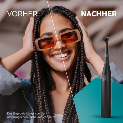 Aufsteckbürsten R2 | Allblack